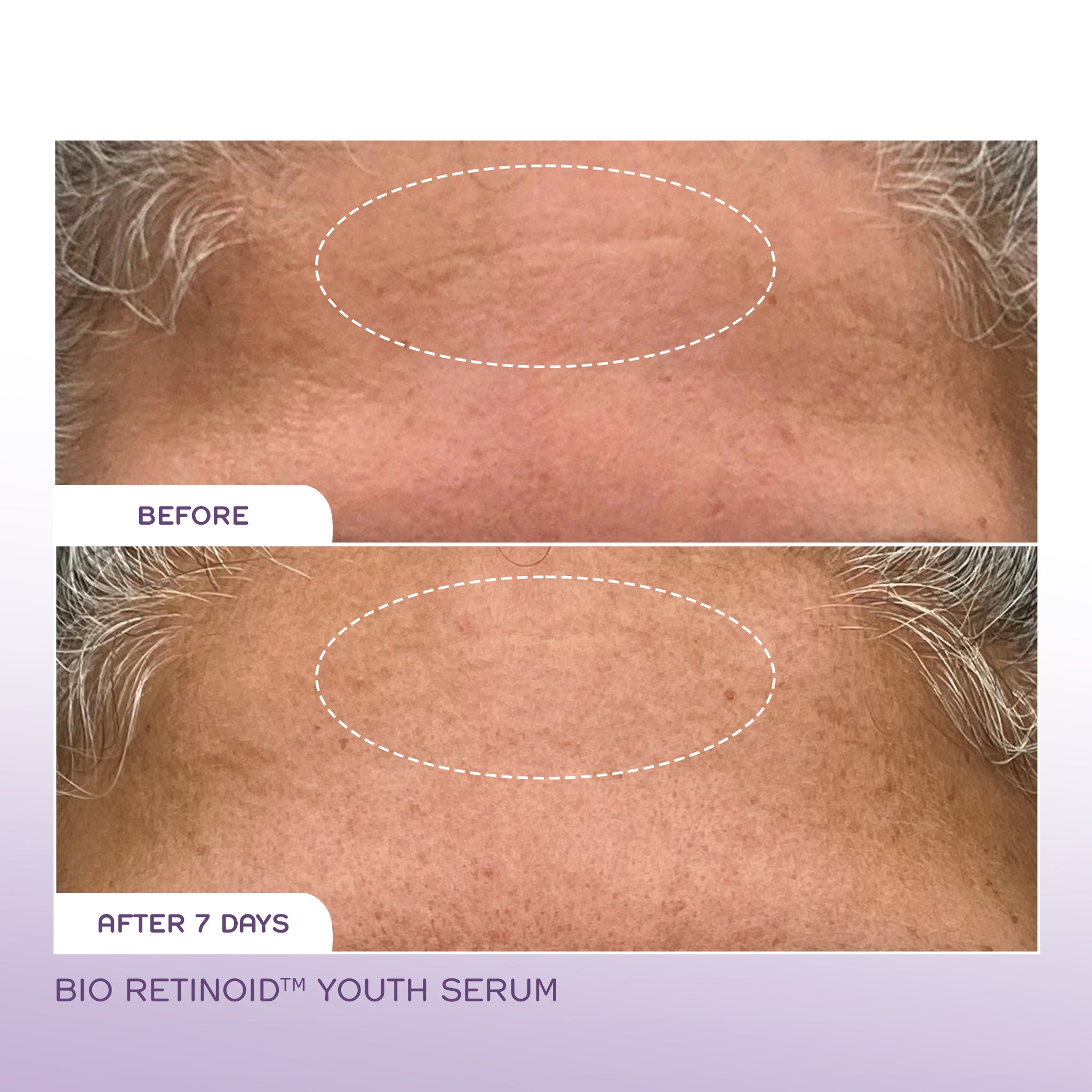 Bio Retinoid™ Youth Serum