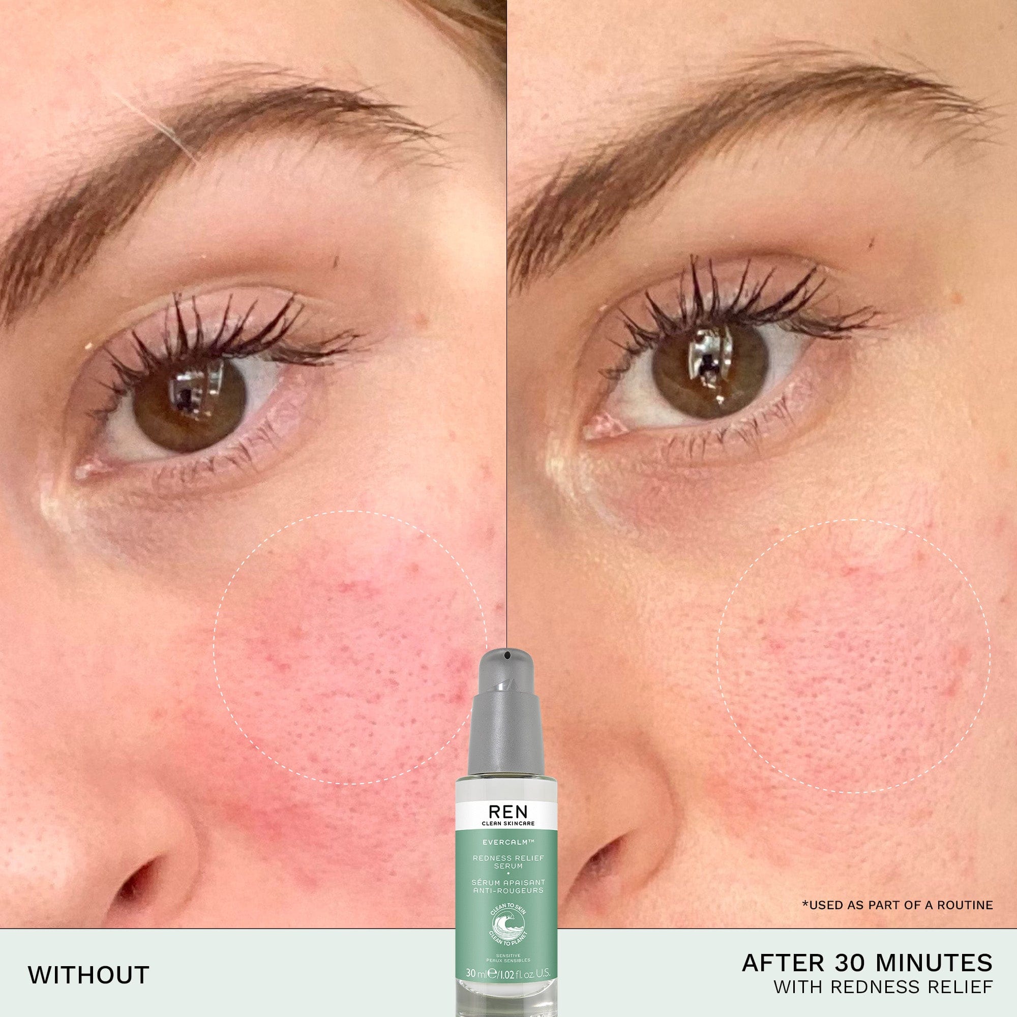 Evercalm™ Redness Relief Serum